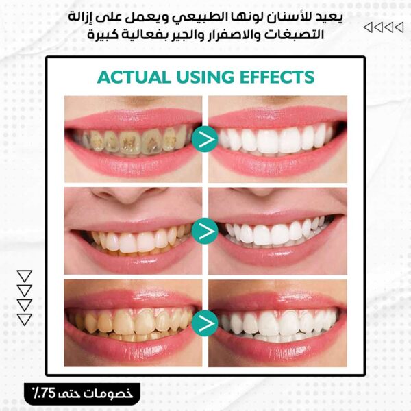 ⁦معجون الأسنان الرغوي⁩ - الصورة ⁦3⁩