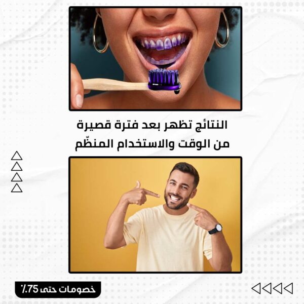 ⁦جيل تبييض الأسنان Hismile⁩ - الصورة ⁦4⁩